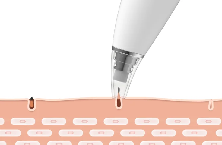 Аппарат вакуумный для чистки лица xiaomi inface blackhead (ms7000) pink
